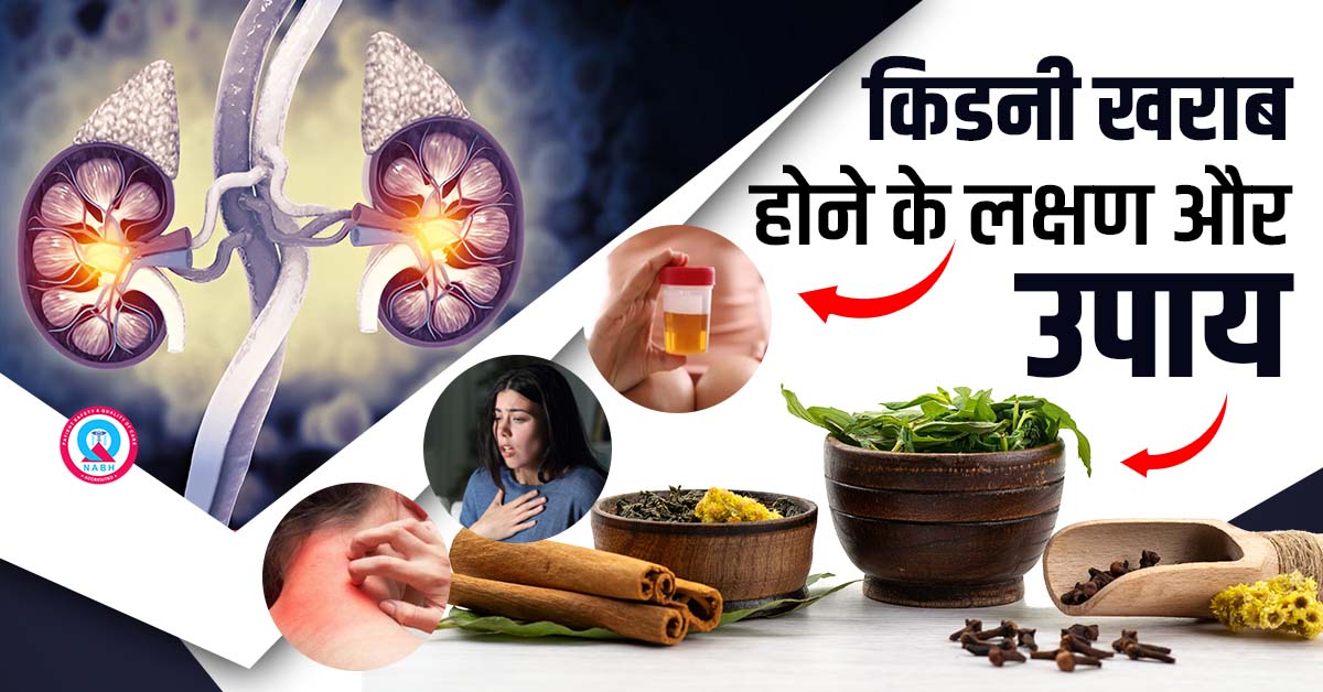 किडनी-खराब-होने-के-लक्षण-और-उपाय